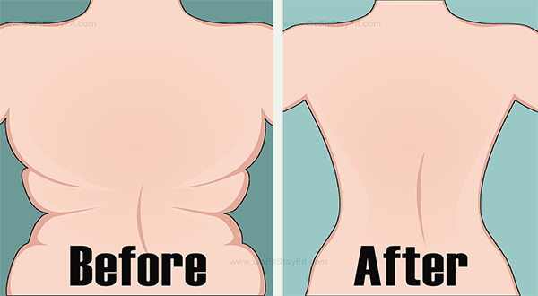How To Get Rid Of Back Fat And Underarm Flab With These 4 Quick Exercises