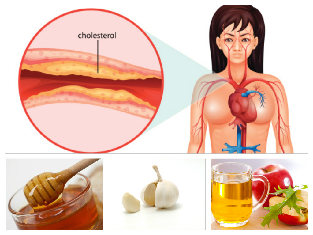 Best Medicine For Cholesterol And High Blood Pressure