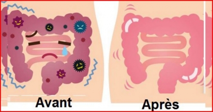 This 2 Ingredient Remedy Flushes Harmful Toxins and Waste From Your Colon