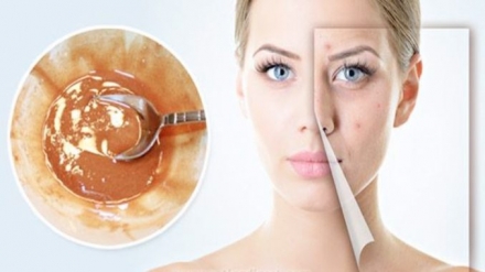 This Face Mask Magically Removes Stains, Acne Scars And Wrinkles After Second Use